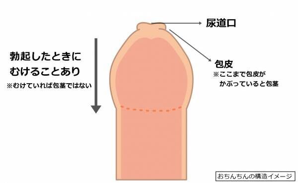 正しく包茎の皮をむく方法とは？包茎を治す方法を分かりやすく解説 - まちかど薬局情報館