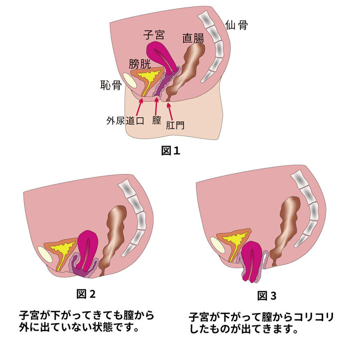 女性泌尿器｜自由が丘ウロケアクリニック｜女性医師が診る、目黒区自由が丘駅の女性泌尿器科・小児泌尿器科