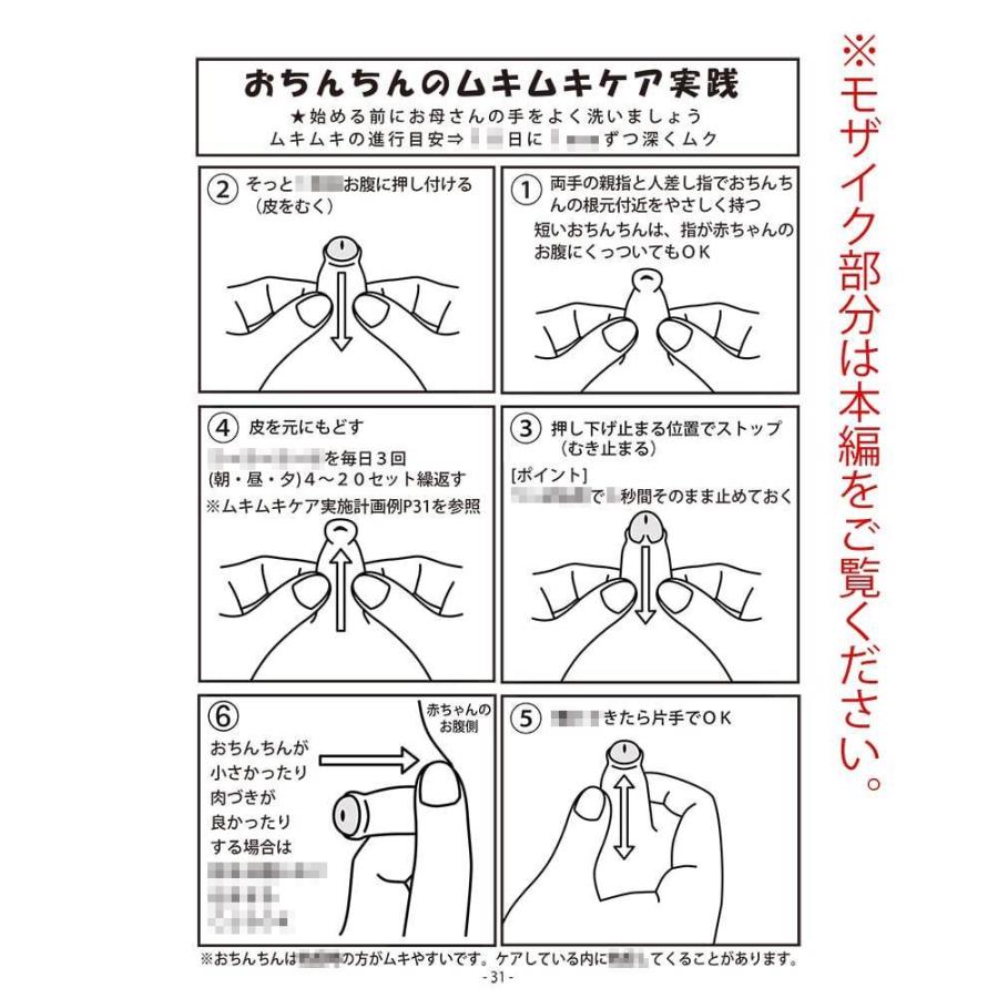 子どもの包茎」むきむき体操（包皮翻転指導）のすすめ – いしゃまち