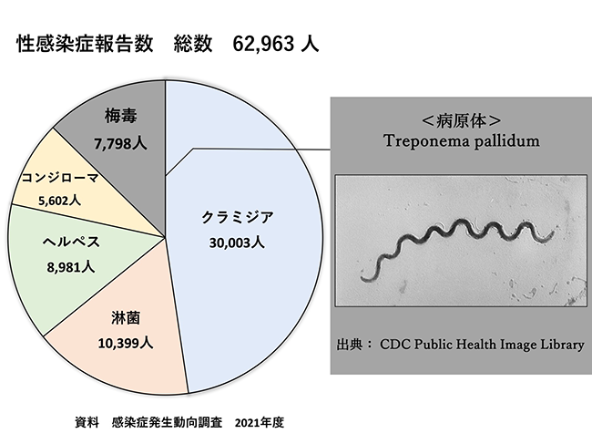 淋病と診断されたときの治療法とは？ - ルナレディースクリニックのメディア