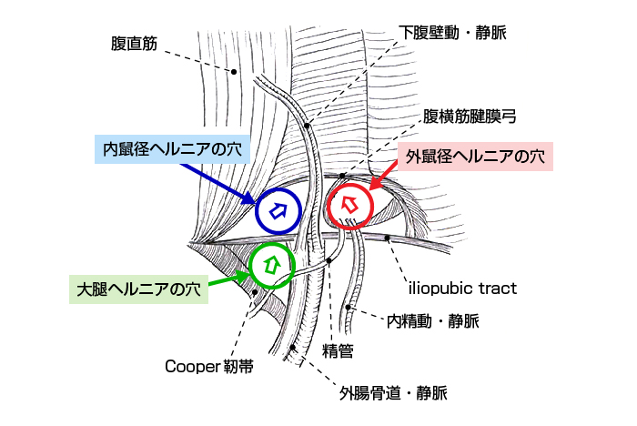 そけいヘルニア - 東京浅草キュアメディクスは台東区上野エリア、浅草駅A5出口1分の鼠径ヘルニア（脱腸）日帰り手術専門クリニックです。