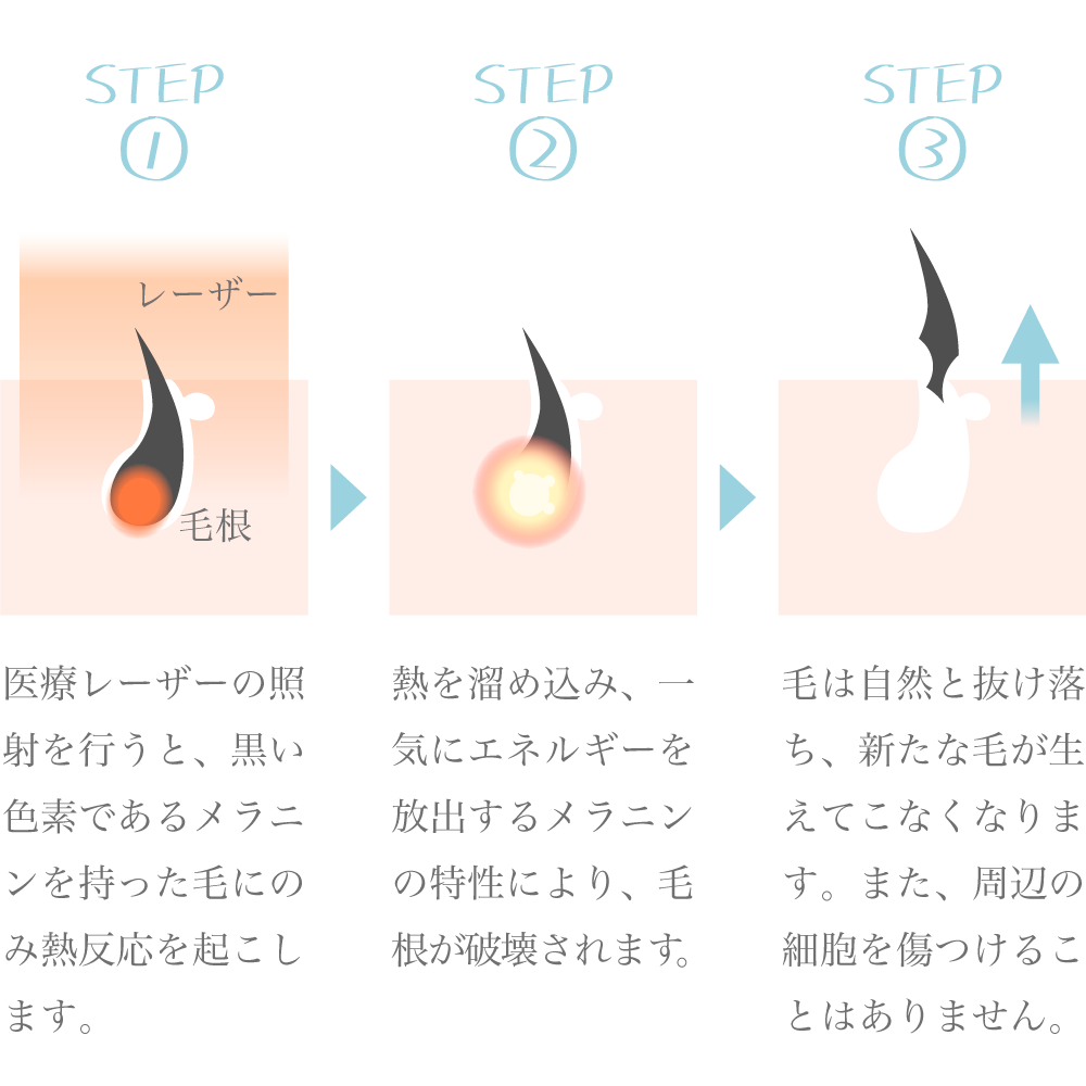 陰毛が濃い男性の印象は？陰毛が濃くなる原因とおすすめの処理方法を解説 | メンズ脱毛百科事典 リンクスペディア