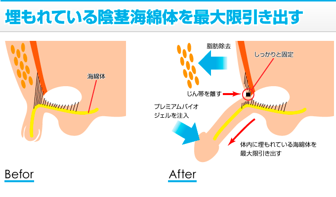 きみのちん長何センチ？ | 魅惑のここっとライフ