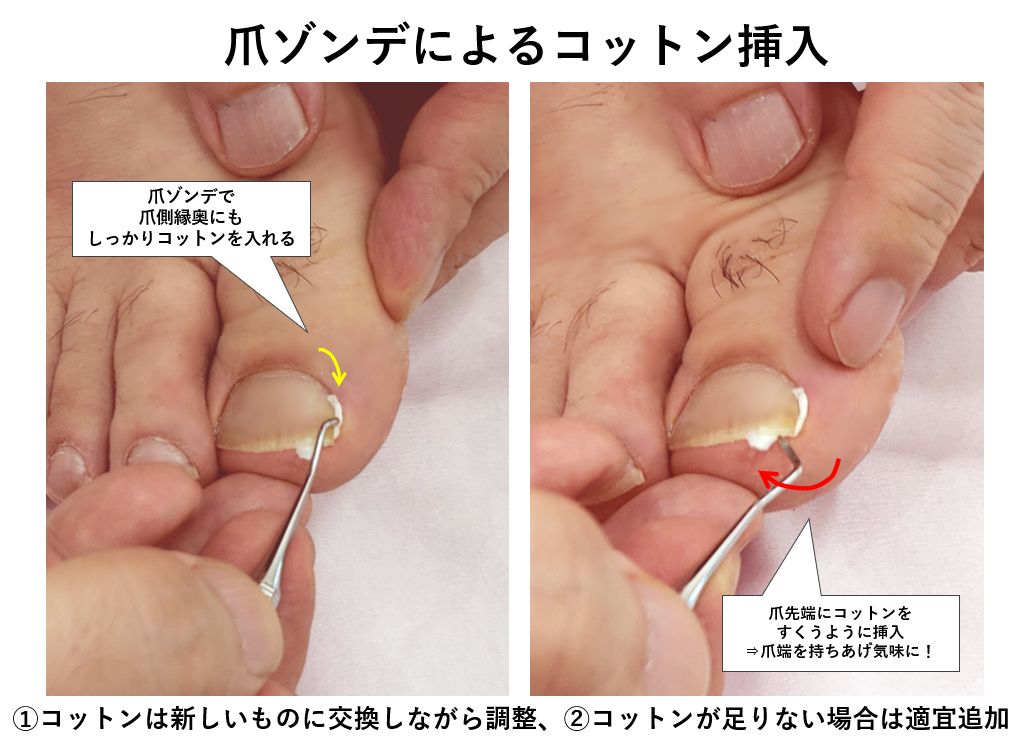 ゴム手袋をはがった人間の手手のジェスチャーを保持しています指の間に挿入するためのスペース色付きのベクターのイラストレーションアイテムを手に入れオブジェクトを人差し  - 営業中の看板のベクターアート素材や画像を多数ご用意