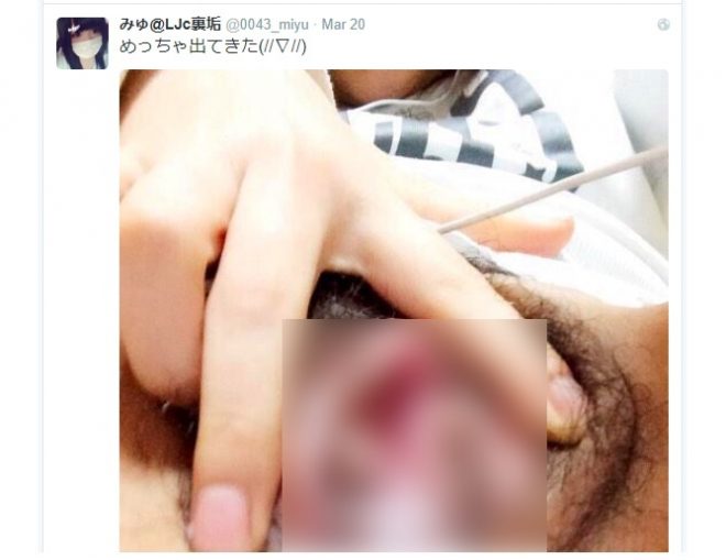 緊急です僕がTwitterでエロいのが見れると聞きTwitterを入れた - Yahoo!知恵袋