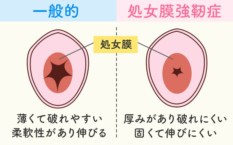 アナルSEX】銀行受付嬢が巨大グレープボムを直腸収納！S字結腸イキがすごかった【個撮】 | アダルト動画・画像のコンテンツマーケット