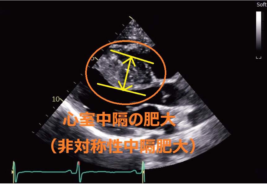 69-4736-56 Labfil® 親水性PTFEシリンジフィルター（プレフィルター付き）25mmΦ 0.45μm