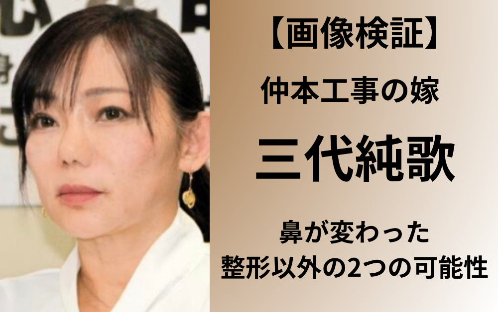 仲本工事さん一周忌 妻・三代純歌が憤慨する「加藤茶妻」の既読スルー…メンバーからは電話の一本もなく | Smart