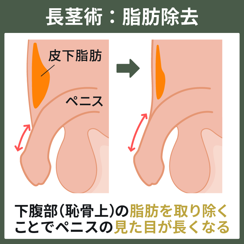 ペニスの大きさ平均は13cm！女性の理想サイズはさらにデカい！？｜薬の通販オンライン