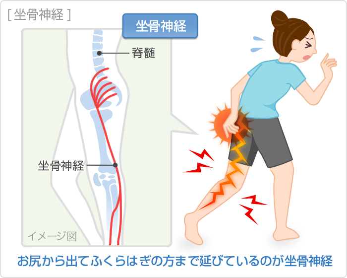 立ちっぱなし、座りっぱなしは要注意 下肢静脈瘤 | サワイ健康推進課