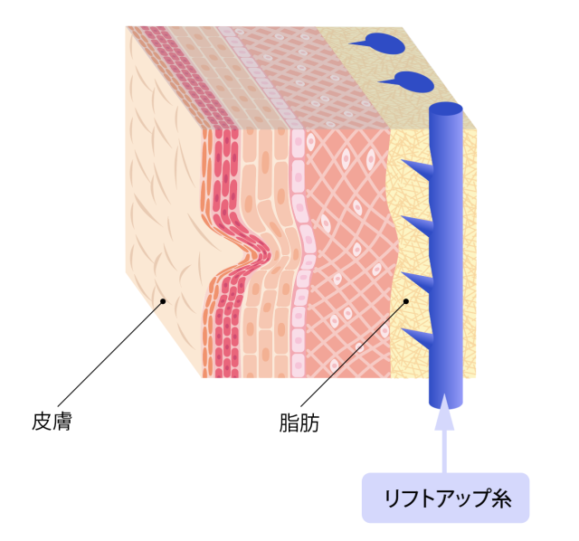 愛知）一宮市中町でつきまとい ９月１３日夜（日本不審者情報センター）｜ｄメニューニュース（NTTドコモ）