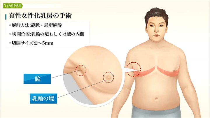 医師監修】妊娠中の胸のトラブル「乳首のかゆみ、チクチク、黒ずみ」「胸の張り」が気になったら｜着ごこち+プラス｜GUNZE（グンゼ）