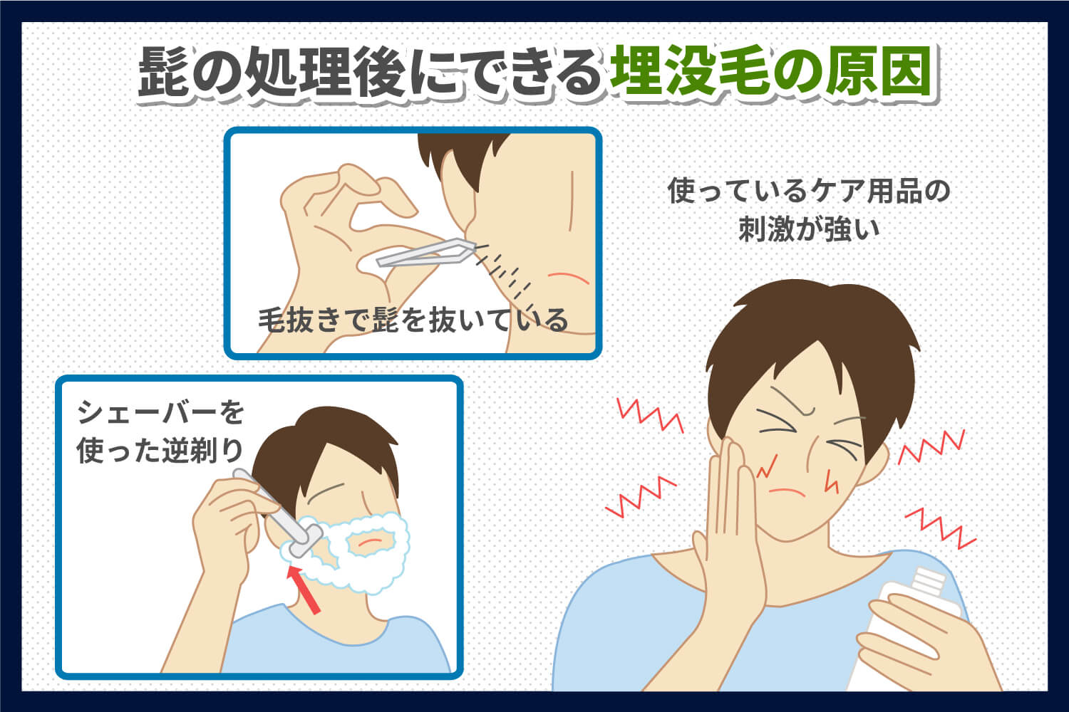 ヒゲ脱毛したら逆に濃くなった！？泥棒ヒゲになる原因「硬毛化」の対策を解説 | メンズタイムズ