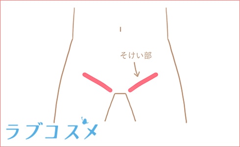 地味に多い尾骨痛へのアプローチ～病態編～ | 理学療法士・作業療法士・言語聴覚士の求人、セミナー情報なら【POST】