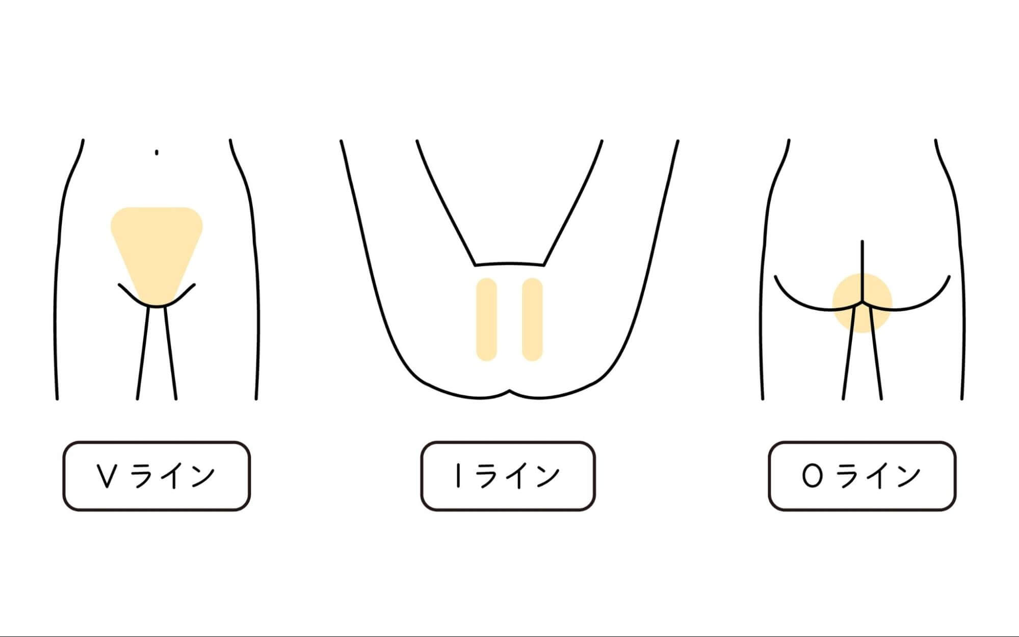 iライン処理ってどうやるの？自己処理の方法から脱毛までのやり方・メリットなどを詳しく解説