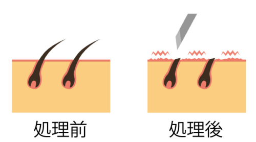 お顔のワックス脱毛のデメリットは❓ | 浜松でまつげパーマ・眉毛サロンはLien(リアン)