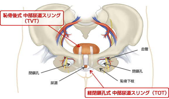 膣ケア・膣トレはデリケートゾーンの不調に効果的！初心者もできる基本方法｜wakanote